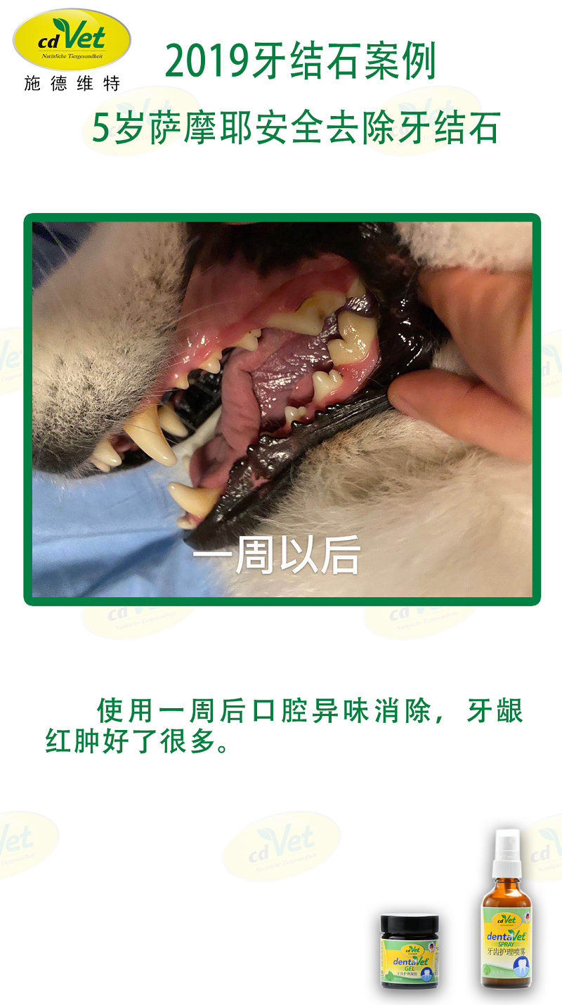 去除牙結(jié)石 2.png