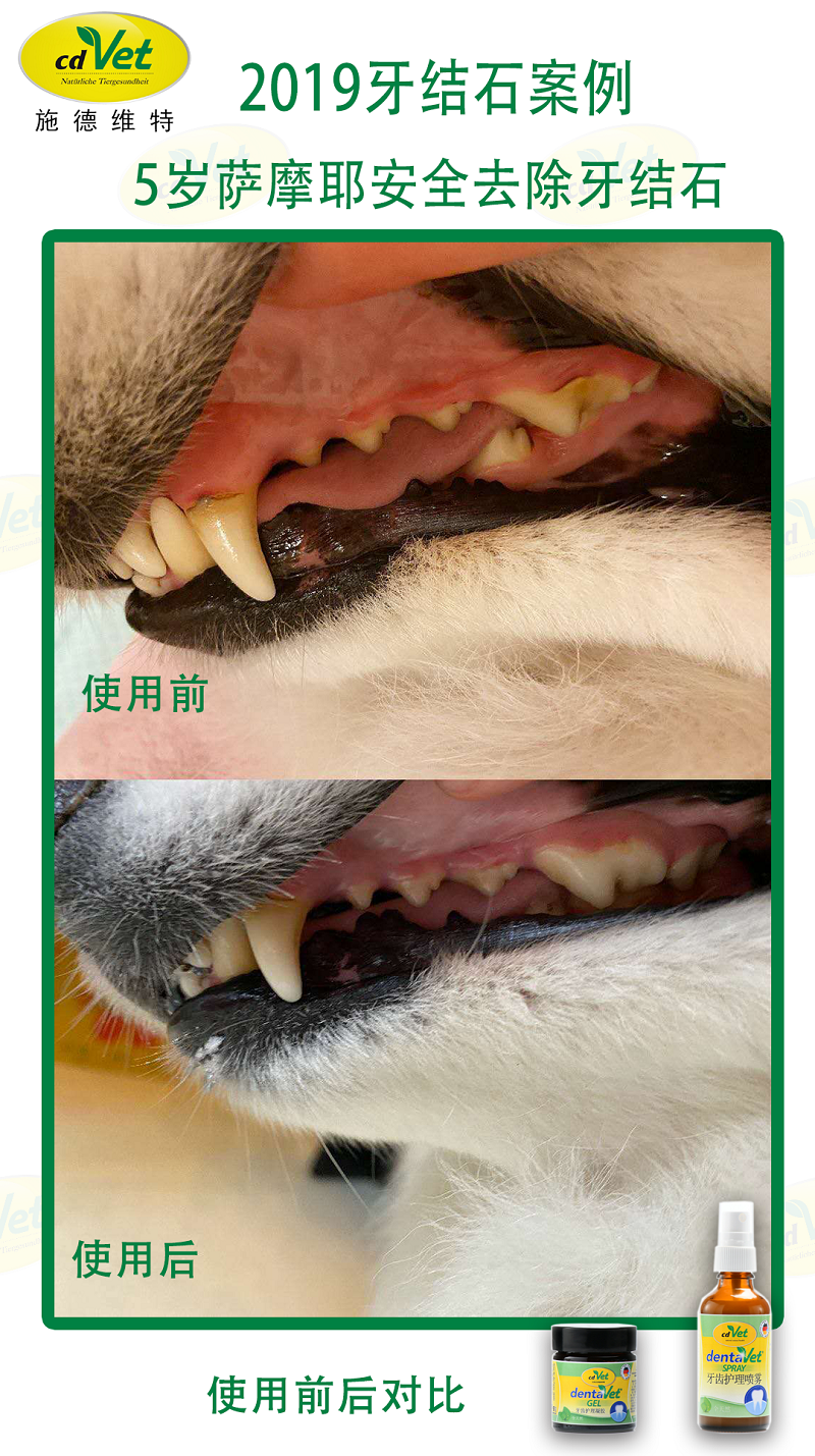 去除牙結(jié)石 7.png